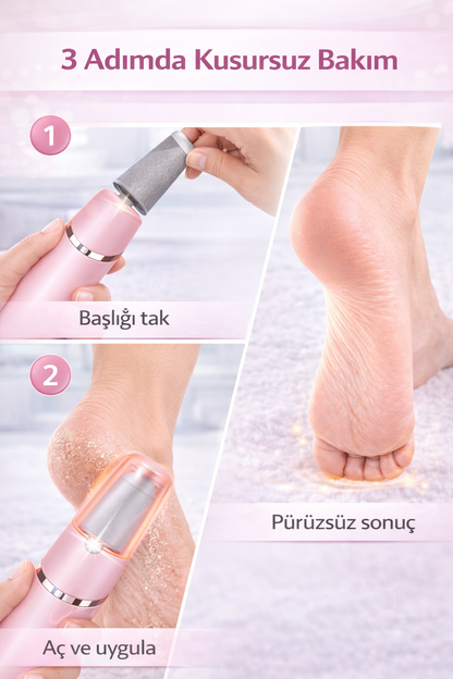 SoftPedi – Elektrikli Nasır ve Ölü Deri Temizleyici