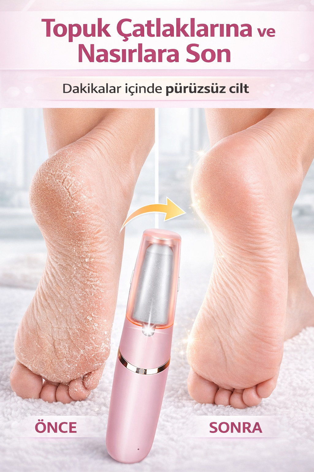 SoftPedi – Elektrikli Nasır ve Ölü Deri Temizleyici
